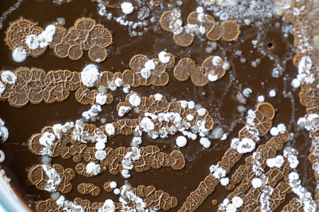 Backgrounds of Characteristics and Different shaped Colony of Bacteria and Mold growing on agar plates from Soil samples for education in Microbiology laboratory.の写真素材