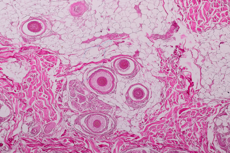 Education anatomy and physiology of Human scalp show of hair folticles under the microscopic in laboratory.の写真素材