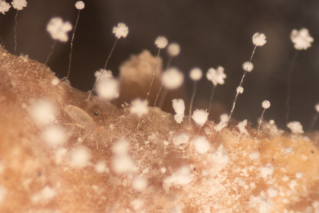 Backgrounds of Colony Characteristics of Mold under the microscope.の写真素材