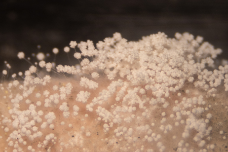 Backgrounds of Colony Characteristics of Mold under the microscope.