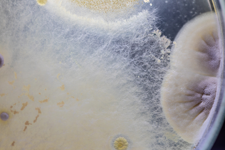 Backgrounds of Colony Characteristics of Mold under the microscope.