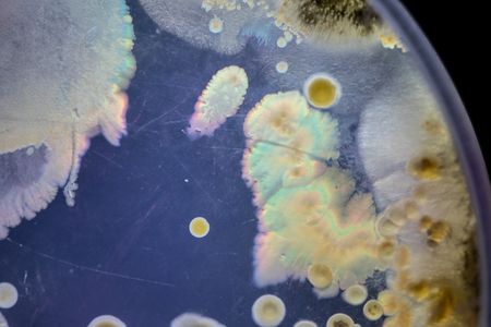 Mold Beautiful, Colony of Characteristics of Fungus (Mold) in culture medium plate from laboratory microbiology.の写真素材