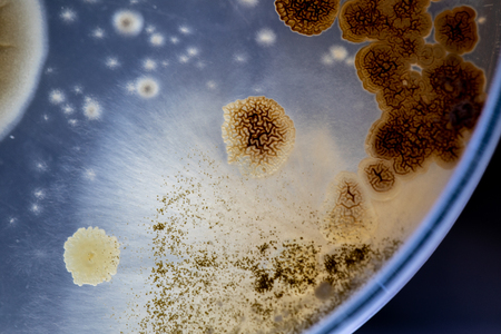 Mold Beautiful, Colony of Characteristics of Fungus (Mold) in culture medium plate from laboratory microbiology.の写真素材