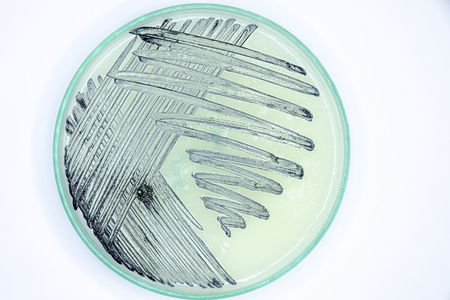 Study Colony characteristic of Actinomyces, Bacteria, yeast and Mold on selective media from soil...