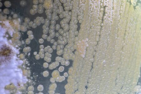 Backgrounds of Characteristics and Different shaped Colony of Bacteria and Mold growing on agar...