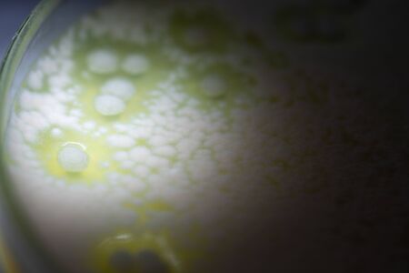 Backgrounds of Characteristics and Different shaped Colony of Bacteria and Mold growing on agar...