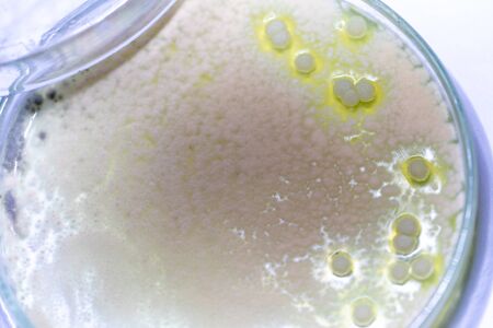 Backgrounds of Characteristics and Different shaped Colony of Bacteria and Mold growing on agar...