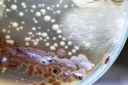 Backgrounds of Characteristics and Different shaped Colony of Bacteria and Mold growing on agar plates from Soil samples for education in Microbiology laboratory.の写真素材