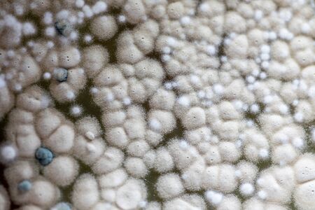 Backgrounds of Characteristics and Different shaped Colony of Bacteria and Mold growing on agar...