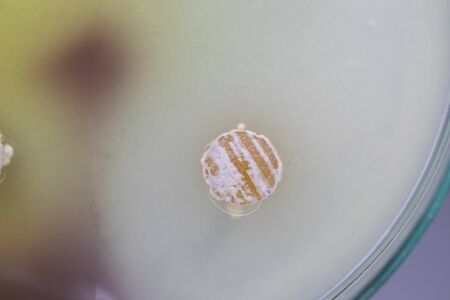 Backgrounds of Characteristics and Different shaped Colony of Bacteria and Mold growing on agar...