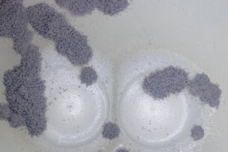 Aspergillus (mold) and yeast for Microbiology in Lab.