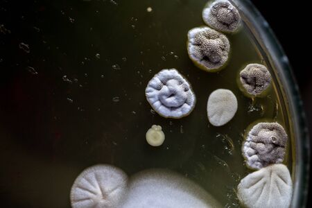 Backgrounds of Colony Characteristics of Fungus and algae in petri dish for education.の写真素材