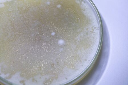Backgrounds of Characteristics and Different shaped Colony of Bacteria and Mold growing on agar...
