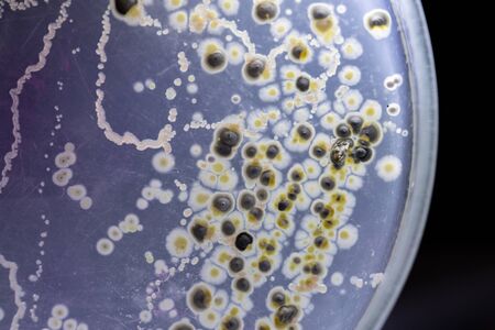 Backgrounds of Characteristics and Different shaped Colony of Bacteria and Mold growing on agar...