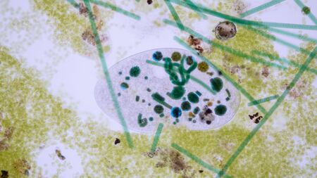 Frontonia sp. is a genus of free-living unicellular ciliate protists under the microscope.