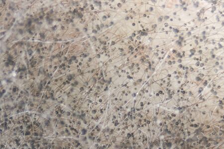Backgrounds Colony Characteristics of Rhizopus (bread mold) is a genus of common saprophytic fungi, Rhizopus (bread mold) under the microscope.(soft focus and have Grain/Noise)の写真素材
