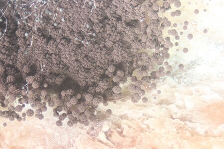 Backgrounds Colony Characteristics of Rhizopus (bread mold) is a genus of common saprophytic fungi, Rhizopus (bread mold) under the microscope.(soft focus and have Grain/Noise)の写真素材