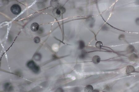 Backgrounds Colony Characteristics of Rhizopus (bread mold) is a genus of common saprophytic fungi,...