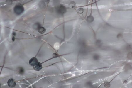 Backgrounds Colony Characteristics of Rhizopus (bread mold) is a genus of common saprophytic fungi, Rhizopus (bread mold) under the microscope.(soft focus and have Grain/Noise)の写真素材