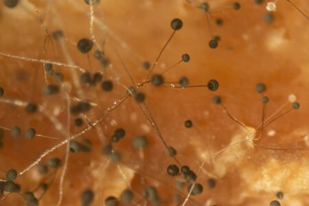 Backgrounds Colony Characteristics of Rhizopus (bread mold) is a genus of common saprophytic fungi,...