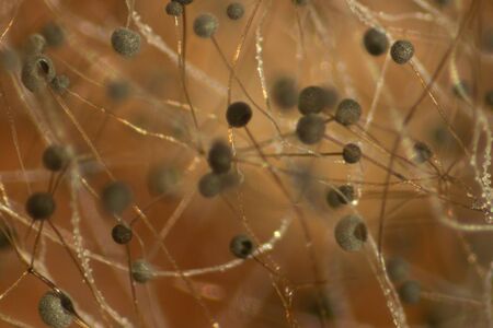 Backgrounds Colony Characteristics of Rhizopus (bread mold) is a genus of common saprophytic fungi,...