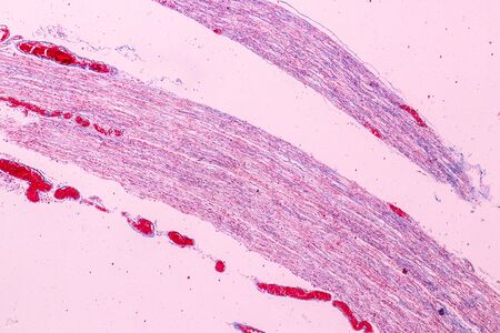Education anatomy and Histological sample Touch corpuscles in skin Tissue under the microscope.