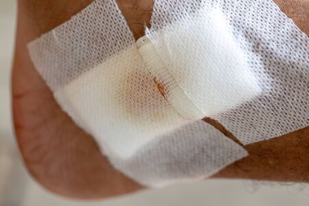 Closeup injured, Fresh wounds from accident.