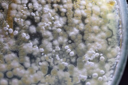 Mold Beautiful, Colony of Characteristics of Fungus (Mold) in culture medium plate from laboratory...