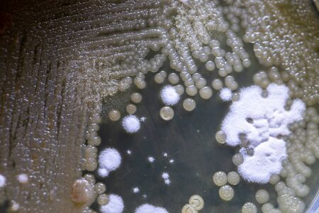 Mold Beautiful, Colony of Characteristics of Fungus (Mold) in culture medium plate from laboratory...