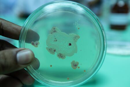 Backgrounds of Colony Characteristics of Bacteria in petri dish for education.の写真素材