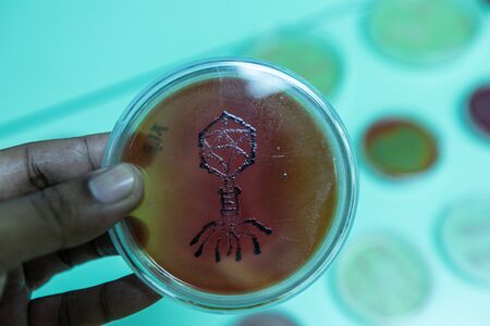 Backgrounds of Colony Characteristics of Bacteria in petri dish for education.の写真素材