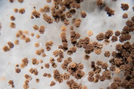Rhizopus (bread mold) is a genus of common saprophytic fungi, Rhizopus (bread mold) under the microscope.の写真素材
