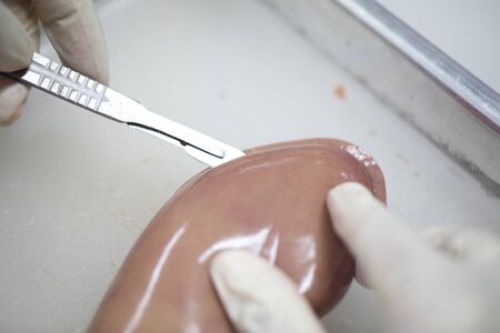 Study and learn about kidney in laboratory.