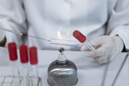 Streak plate for Bacteria culture or identify Bacteria research in labmicrology.