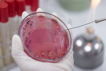 Streak plate for Bacteria culture or identify Bacteria research in labmicrology.の写真素材
