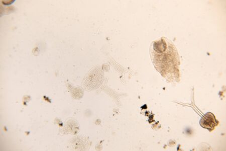 Study Movement and Specimens of Transversotrema patiallensis (parasite) under the microscopic in...