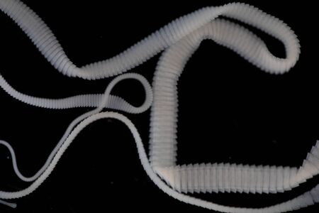 The study of Tapeworm infection is caused by ingesting food or water contaminated with tapeworm eggs...
