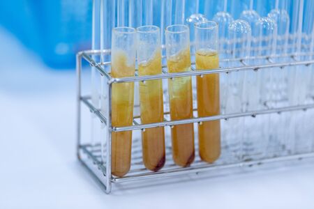 Biodiesel production is the process of producing the biofuel, biodiesel, in laboratory.の写真素材