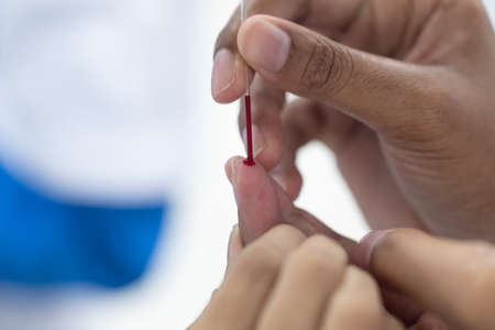 Study of Hepatitis-B Detection in laboratories.