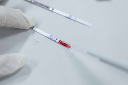 Study of Hepatitis-B Detection in laboratories.