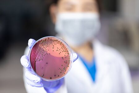 Analysis and study vaccine of Coronaviruses disease (CoV) in the laboratory.