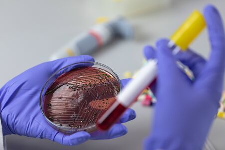 Analysis and study vaccine of Coronaviruses disease (CoV) in the laboratory.