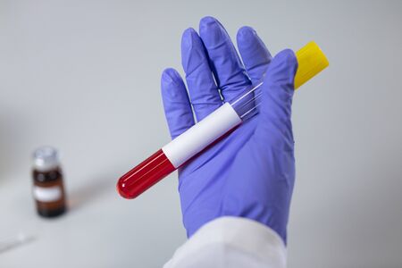 Analysis and study vaccine of Coronaviruses disease (CoV) in the laboratory.