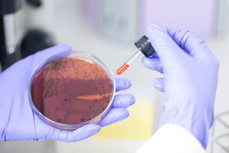 Analysis and study vaccine of Coronaviruses disease (CoV) in the laboratory.