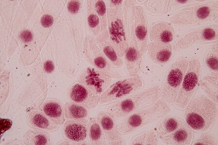 Root tip of Onion and Mitosis cell in the Root tip of Onion under a microscope.
