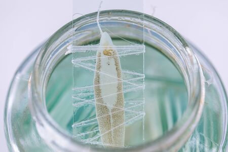 Patterns and backgrounds of Parasitic, Study of Parasitic and Anatomical pathology in laboratory.