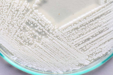 Yeast in petri dish, Microbiology for education in laboratories.