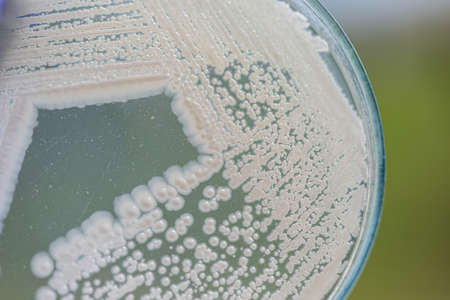 Yeast in petri dish, Microbiology for education in laboratories.の写真素材