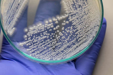 Yeast in petri dish, Microbiology for education in laboratories.