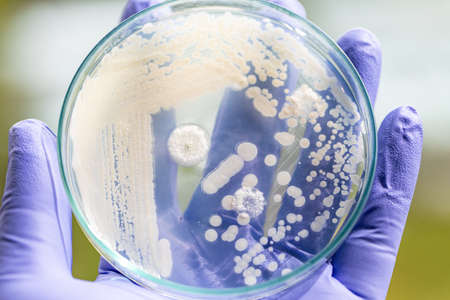Pichia is a genus of yeasts in the family Saccharomycetaceae under the microscope for education.の写真素材